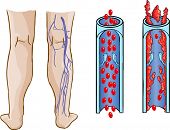 image of vein  - thrombocyte - JPG 
